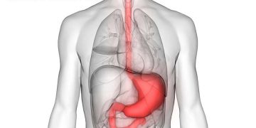 What is Stomach Cancer