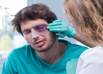 Degloved Face Injury