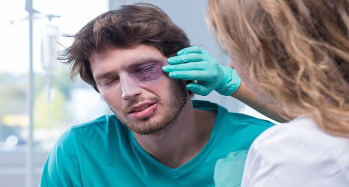 Degloved Face Injury